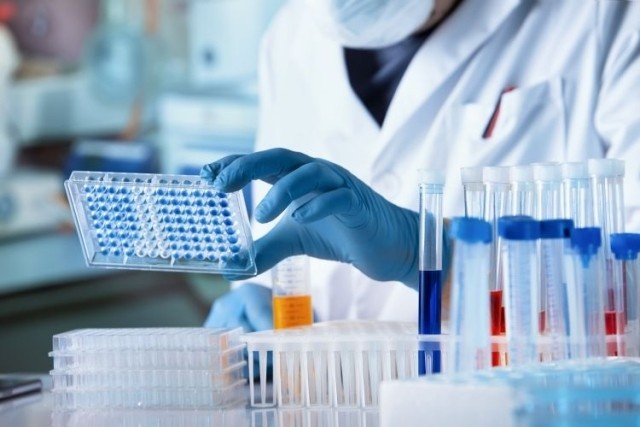 Researcher working with microplate panel for diseases diagnosis in the laboratory
